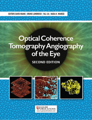 Optical Coherence Tomography Angiography of the Eye | Second edition