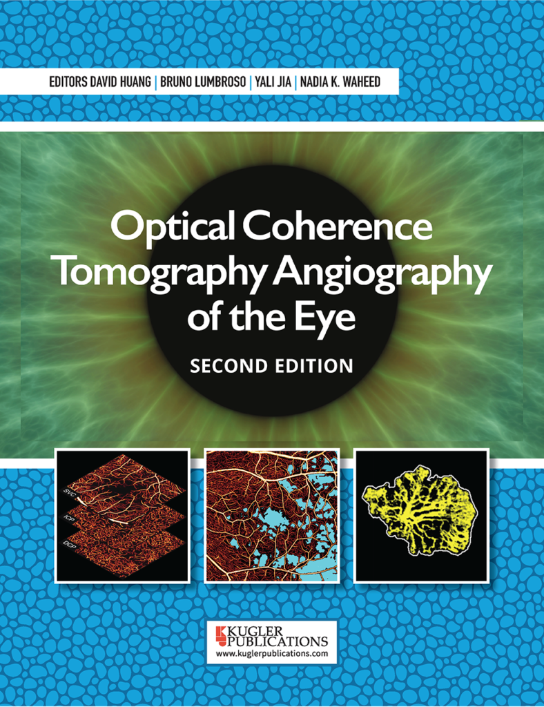 Optical Coherence Tomography Angiography Of The Eye | Second Edition ...