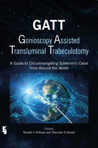 GATT: Gonioscopy Assisted Transluminal Trabeculotomy